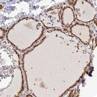 Immunohistochemical staining of human thyroid gland shows moderate cytoplasmic and nuclear positivity in glandular cells.