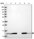 Lane 1: Marker [kDa] 250, 130, 95, 72, 55, 36, 28, 17, 10_br/_Lane 2: Human cell line RT-4_br/_Lane 3: Human cell line U-251MG sp_br/_Lane 4: Human plasma (IgG/HSA depleted)_br/_Lane 5: Human liver tissue_br/_Lane 6: Human tonsil tissue