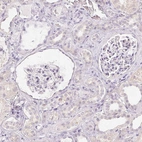 Immunohistochemical staining of human kidney shows no positivity in cells in tubules and glomeruli as expected.