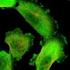 Immunofluorescent staining of human cell line U-251 MG shows localization to plasma membrane & cytosol.