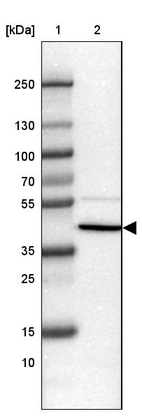 Lane 1: Marker [kDa] 250, 130, 100, 70, 55, 35, 25, 15, 10_br/_Lane 2: Human Liver tissue