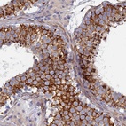 Anti-PCDHA8 Antibody