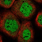 Immunofluorescent staining of human cell line A-431 shows localization to nucleoplasm.