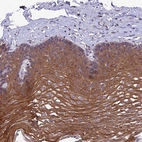 Immunohistochemical staining of human esophagus shows high expression.
