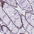 Immunohistochemical staining of human colon shows low expression as expected.