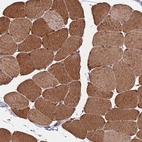 Immunohistochemical staining of human skeletal muscle shows moderate to strong cytoplasmic positivity in myocytes.