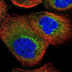 Immunofluorescent staining of human cell line A-431 shows localization to cytosol & the Golgi apparatus.