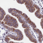 Immunohistochemical staining of human fallopian tube shows moderate cytoplasmic positivity in glandular cells.
