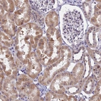 Immunohistochemical staining of human kidney shows moderate cytoplasmic positivity in cells in tubules.