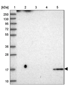 Lane 1: Marker [kDa] 250, 130, 95, 72, 55, 36, 28, 17, 10_br/_Lane 2: Human cell line RT-4_br/_Lane 3: Human cell line U-251MG sp_br/_Lane 4: Human plasma (IgG/HSA depleted)_br/_Lane 5: Human liver tissue