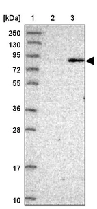 Lane 1: Marker [kDa] 250, 130, 95, 72, 55, 36, 28, 17, 10_br/_Lane 2: Human cell line RT-4_br/_Lane 3: Human cell line U-251MG sp