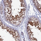 Anti-SRA1 Antibody