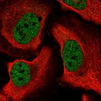 Immunofluorescent staining of human cell line U-2 OS shows localization to nucleoplasm.