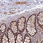Anti-TIGD6 Antibody