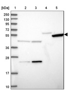 Lane 1: Marker [kDa] 250, 130, 95, 72, 55, 36, 28, 17, 10_br/_Lane 2: Human cell line RT-4_br/_Lane 3: Human cell line U-251MG sp_br/_Lane 4: Human plasma (IgG/HSA depleted)_br/_Lane 5: Human liver tissue