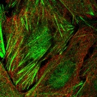 Immunofluorescent staining of human cell line U-2 OS shows localization to nucleoplasm & actin filaments.