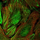 Immunofluorescent staining of human cell line U-2 OS shows localization to nucleoplasm & actin filaments.