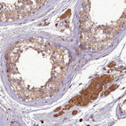 Anti-TMEM258 Antibody