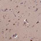 Immunohistochemical staining of human Cerebral cortex shows moderate granular cytoplasmic positivity in neuronal cells.