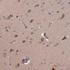 Immunohistochemical staining of human Cerebral cortex shows moderate granular cytoplasmic positivity in neuronal cells.