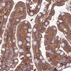 Immunohistochemical staining of human Small intestine shows moderate granular cytoplasmic positivity in glandular cells.