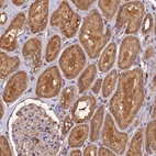 Immunohistochemical staining of human Kidney shows moderate granular cytoplasmic positivity in cells in tubules.