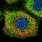 Immunofluorescent staining of human cell line A-431 shows positivity in plasma membrane & cytoplasm.