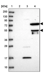 Lane 1: Marker [kDa] 250, 130, 95, 72, 55, 36, 28, 17, 10_br/_Lane 2: Human cell line RT-4_br/_Lane 3: Human cell line U-251MG sp_br/_Lane 4: Human plasma (IgG/HSA depleted)