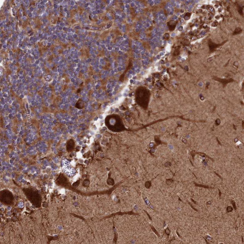 Anti-SPOCK2 Antibody