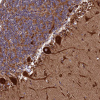 Anti-SPOCK2 Antibody