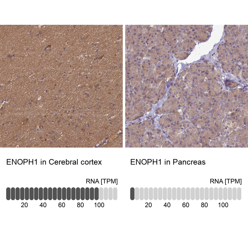 Anti-ENOPH1 Antibody