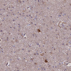 Anti-SPOCK2 Antibody