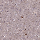 Immunohistochemical staining of human cerebral cortex shows moderate cytoplasmic positivity in neurons.