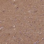 Immunohistochemical staining of human cerebral cortex shows high expression.