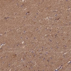 Immunohistochemical staining of human cerebral cortex shows high expression.