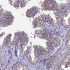 Immunohistochemical staining of human prostate shows moderate cytoplasmic positivity in glandular cells.