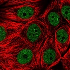 Immunofluorescent staining of human cell line MCF7 shows localization to nucleoplasm & nuclear bodies.