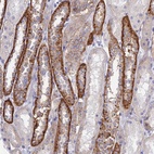 Anti-CHSY3 Antibody