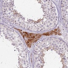 Anti-PTCHD3 Antibody