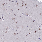 Anti-NABP2 Antibody