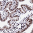 Immunohistochemical staining of human fallopian tube shows strong nuclear positivity in glandular cells.