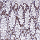 Anti-NABP2 Antibody