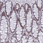 Immunohistochemical staining of human colon shows strong nuclear positivity in glandular cells.