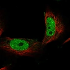 Immunofluorescent staining of human cell line U-251 MG shows localization to nucleoplasm.