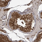 Anti-KLC1 Antibody