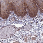 Anti-C15orf62 Antibody