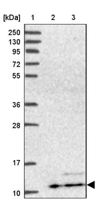 Lane 1: Marker [kDa] 250, 130, 95, 72, 55, 36, 28, 17, 10_br/_Lane 2: Human cell line RT-4_br/_Lane 3: Human cell line U-251MG sp