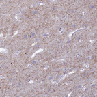 Anti-GAD2 Antibody