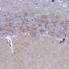Immunohistochemical staining of human cerebellum shows moderate granular cytoplasmic positivity in cells in molecular layer.