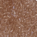 Anti-GNPNAT1 Antibody